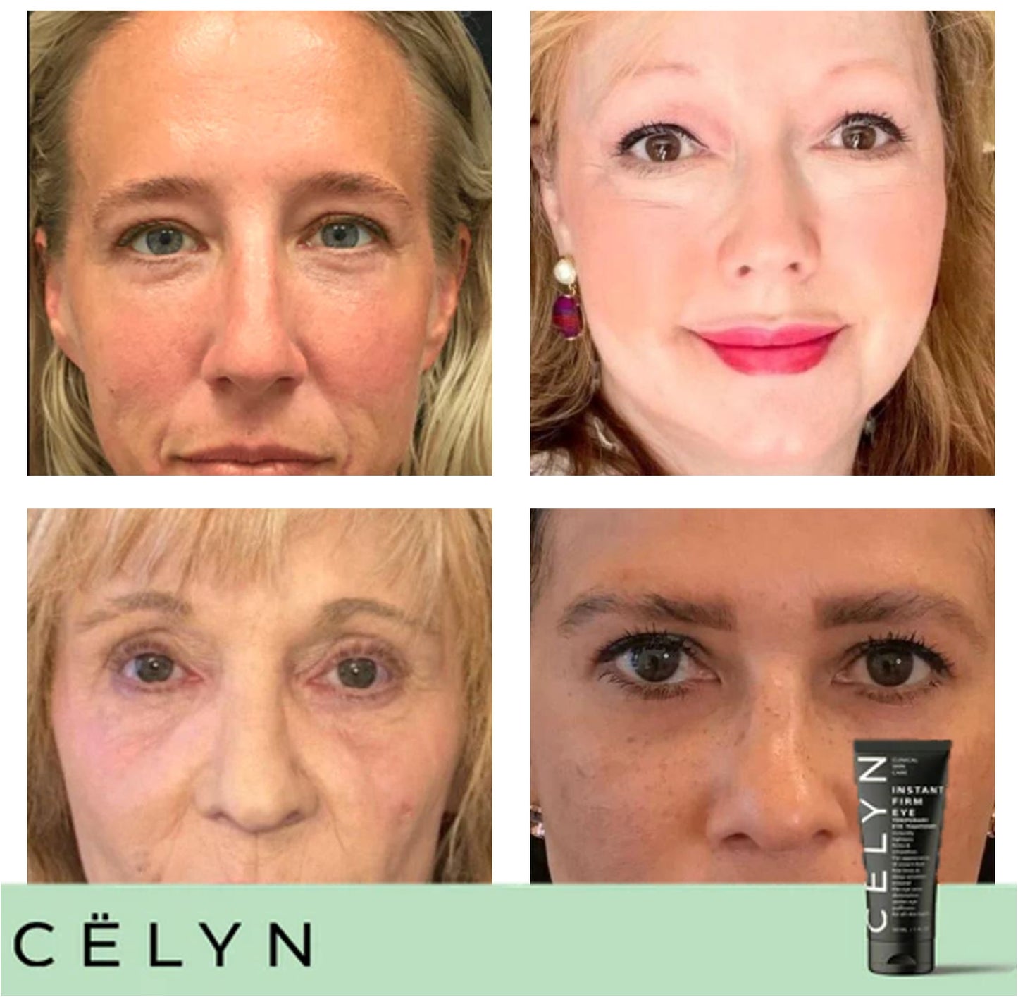 CËLYN CREAM™ | Anti-poser krem | 1+1 gratis